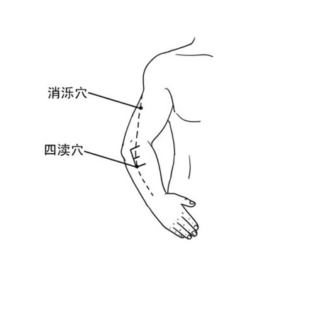 消濼穴→治頭痛、頸項強痛