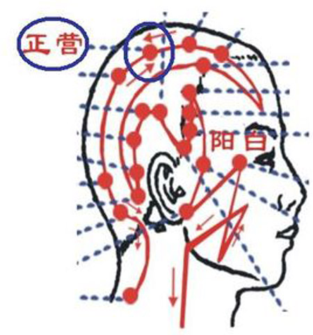 正營穴→治頭痛、頭暈