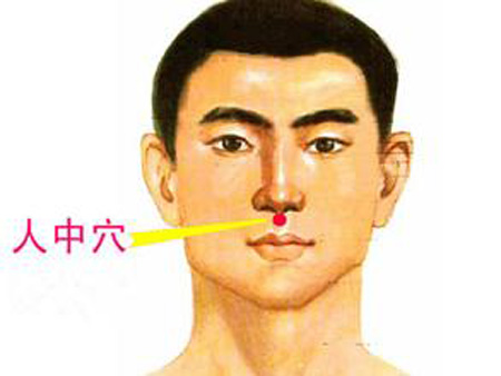 水溝穴→治昏迷、暈厥