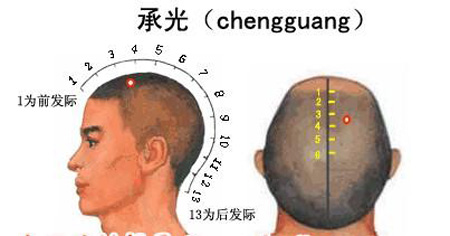 承光穴→治頭痛、鼻炎