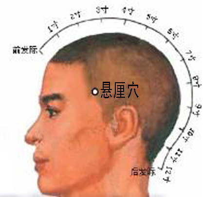 懸厘穴→治偏頭痛、面腫