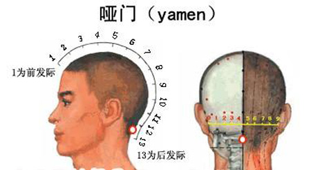 啞門穴→治音啞、頭痛