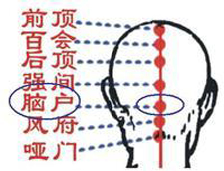 腦戶穴→治頭重、頭痛