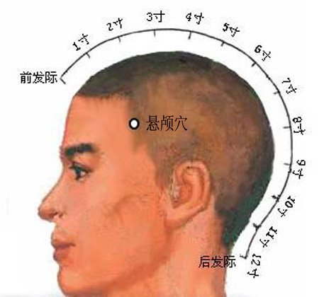 懸顱穴→治偏頭痛、面腫