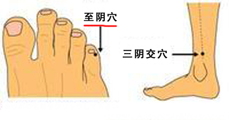 至陰穴→治頭痛、目痛