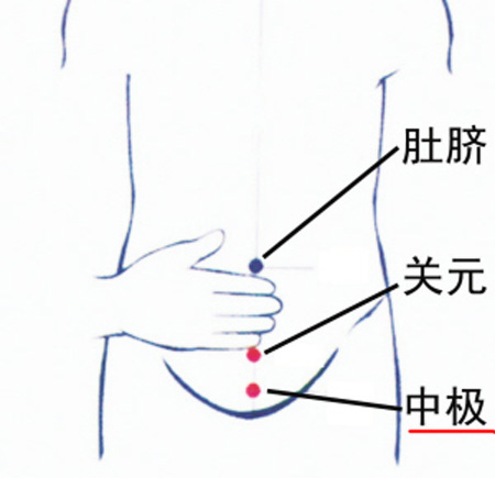 中極穴：補腎培元，調(diào)治陰挺、不孕