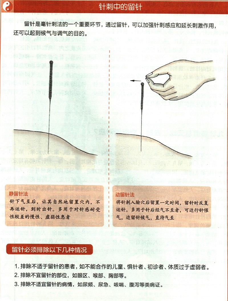 針刺穴位時有哪些需要注意的？