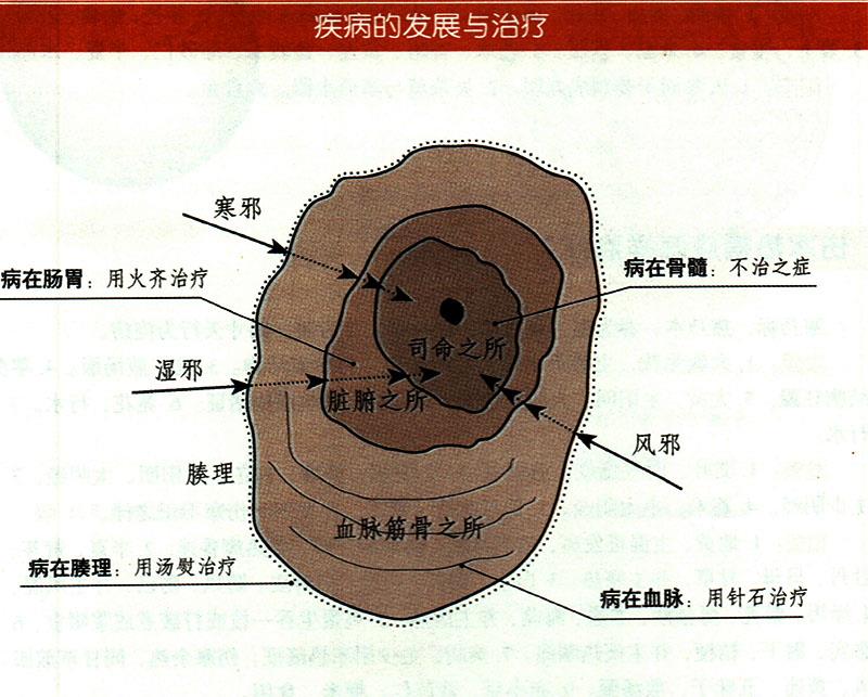 諸氣應(yīng)怎樣治療？