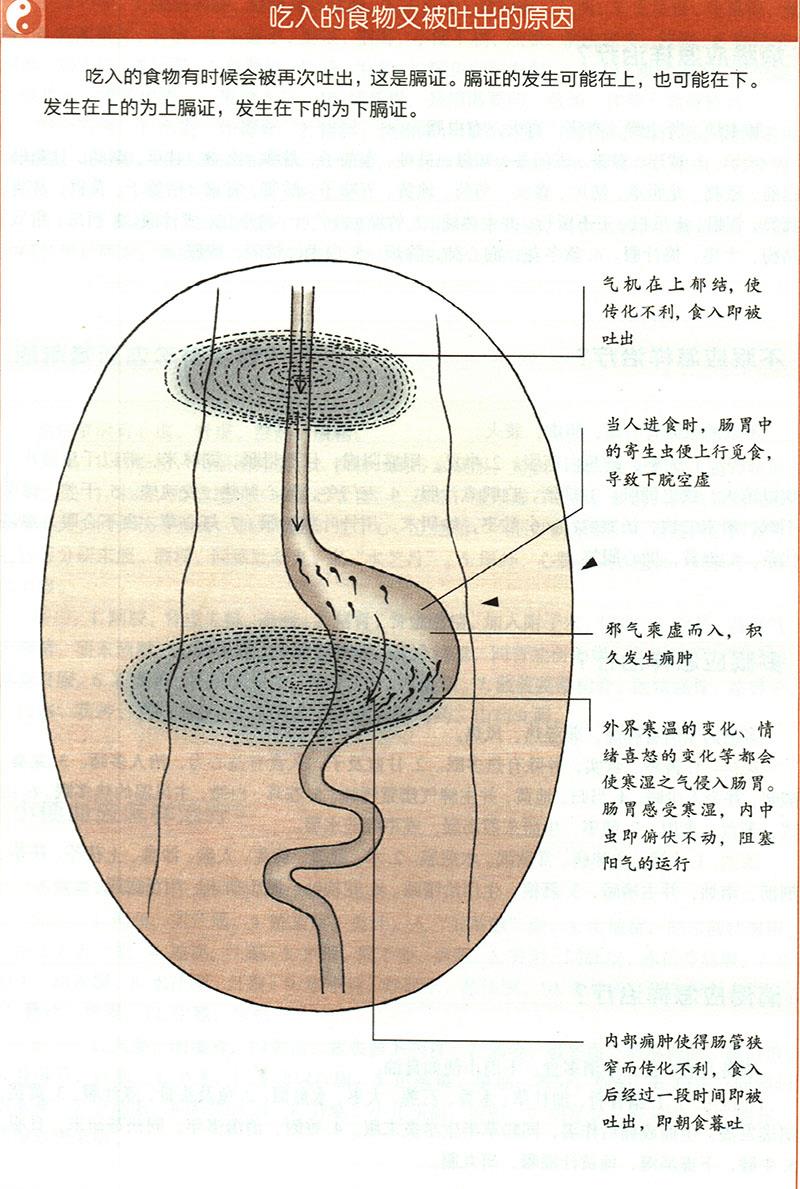 嘔吐應(yīng)怎樣治療？