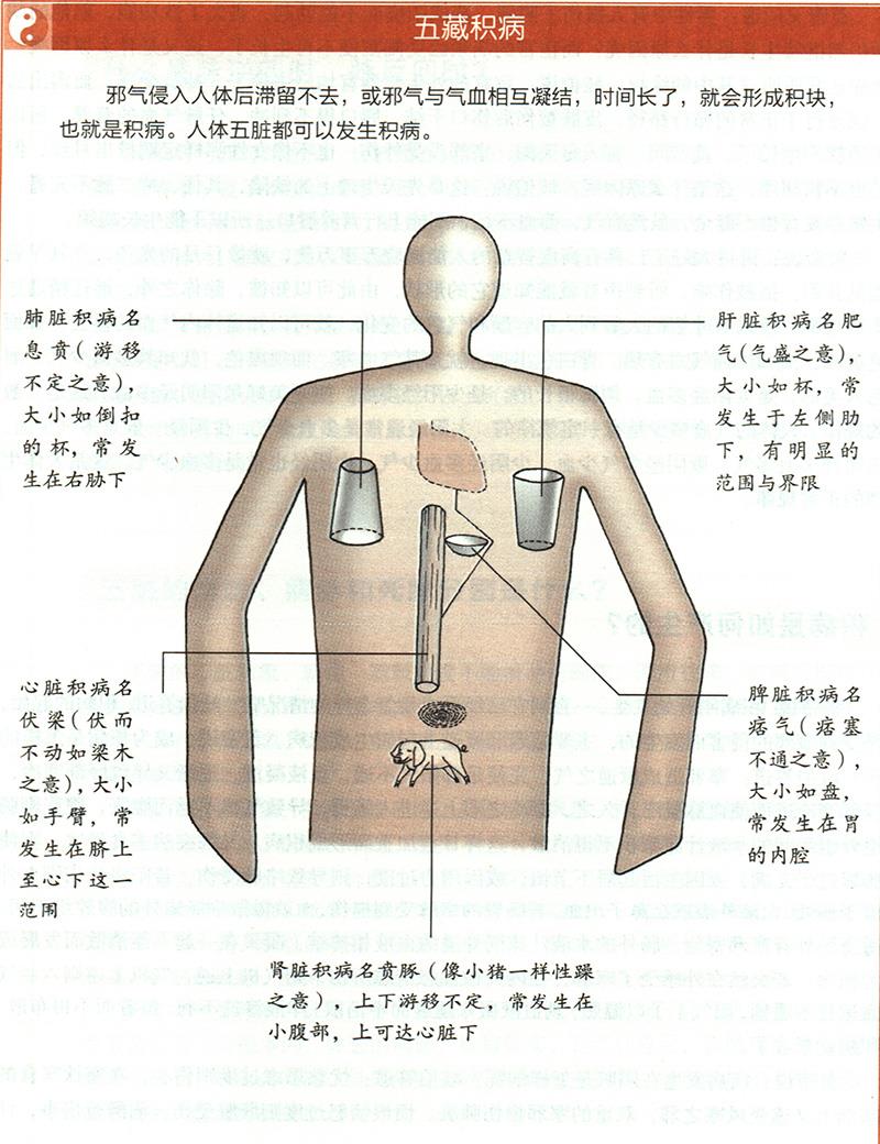 積病是如何產(chǎn)生的？