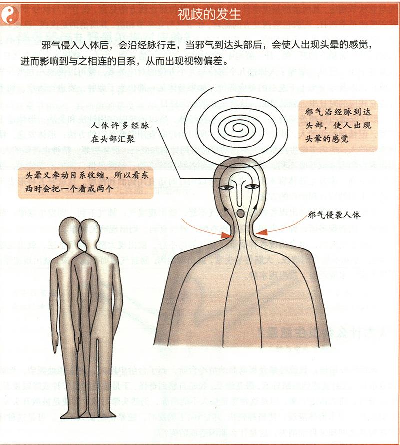 人為什么會發(fā)生眩暈？
